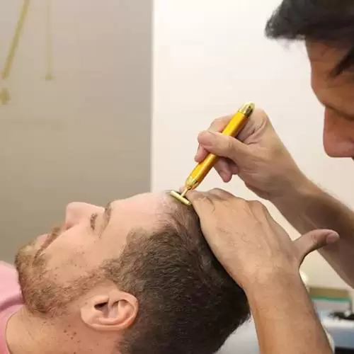 Màs Pelo
